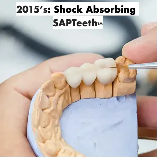 2015's: Shock Absorbing SAPTeeth