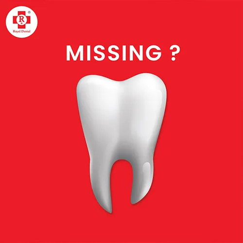 High Impact Composite SAPTeeth